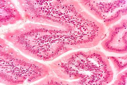 Intestinal_villi_close_up