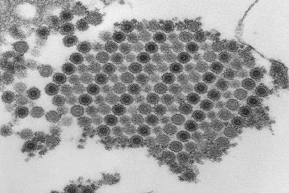 Chikungunya_virus_particles-PHIL-17369