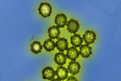 H1N1_Influenza_Virus_Particles_(8411599236)