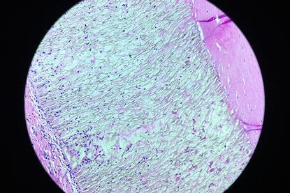 PTFE_(polytetrafluoroethylene)_-_Teflon_(49615920942)