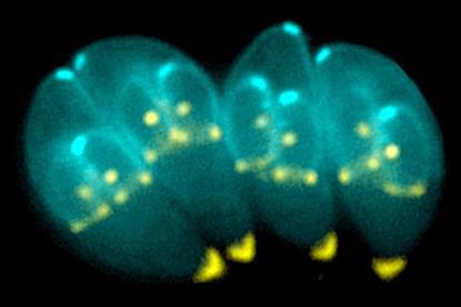 Toxoplasma_gondii