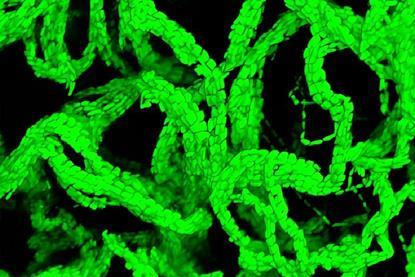 Bacteria forming cables that tangle together