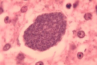 Histopathology_of_malaria_exoerythrocytic_forms_in_liver_07G0024_lores (1)