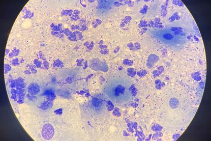 Chlamydia-22Feb25