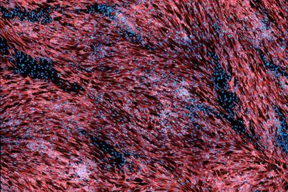 Low-Res_HF_MPXV_semen_Torbica_et_al_EmergingMicrobesInfections_2026