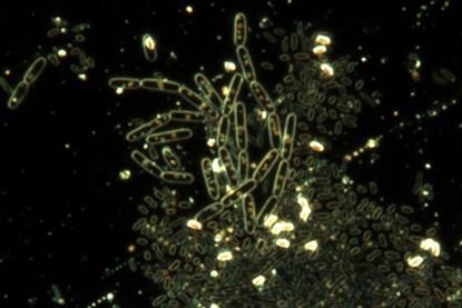 Spores_of_Bacillus_subtilis.tif