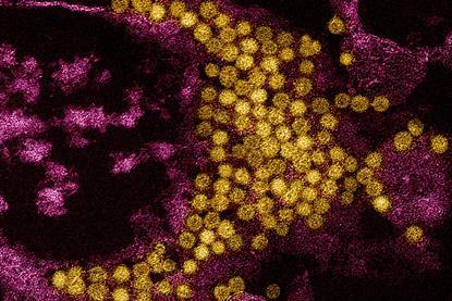 Enterovirus_D68_Virus_particles_colorized_transmission_electron_micrograph_-_211