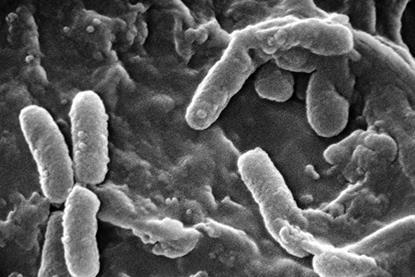 Pseudomonas_aeruginosa_SEM