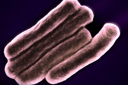 Mycobacterium_Tuberculosis_Bacteria,_the_Cause_of_TB_(52766722758)