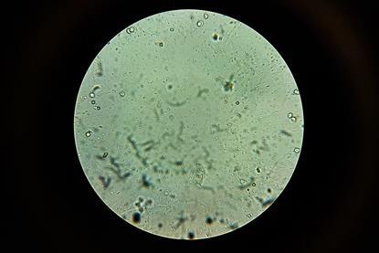 Urine_Sample