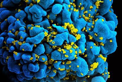960px-HIV-infected_T_cell_(6813384933) (1)
