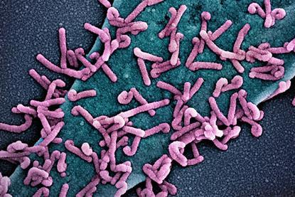 Marburg_virus_outbreak