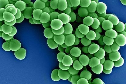 Methicillin-Resistant_Staphylococcus_Aureus_(MRSA)_Bacteria_colorized_scanning_electron_micrograph_-_44