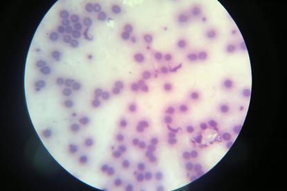 Trypanosoma_cruzi