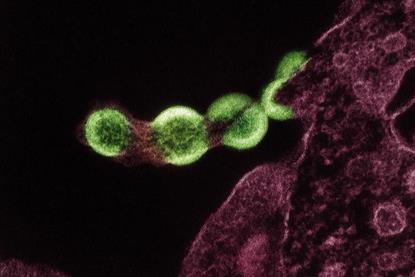 Low-Res_hiv-1-virus-particles-green
