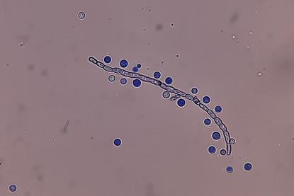 LPCB_Mount_of_Cryptococcus_growth_on_SDA_microscopic_footage