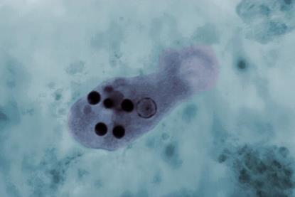 Micrograph_of_Entamoeba_histolytica