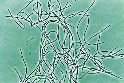 Immagine_chloroflexi_JPEG