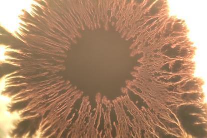 Beautiful_eye_shaped_Bacillus_subtilis_bacterial_growth_under_the_microscope_14