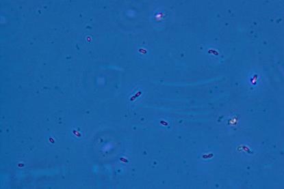 Geobacter_sulfurreducens.TIF