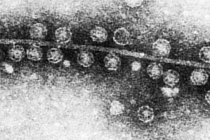 Bacteriophage_Qβ_attached_to_sex_pilus_of_E._coli