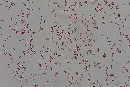 Gram_Negative_bacilli_of_Klebsiella_in_Gram_stained_smear_of_culture