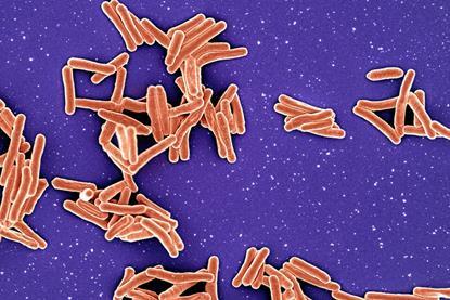 Mycobacterium_Tuberculosis_Bacteria