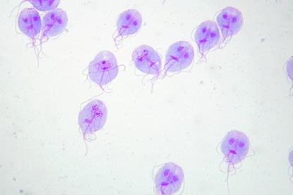 Giardia_trophozoites_Giemsa.tif