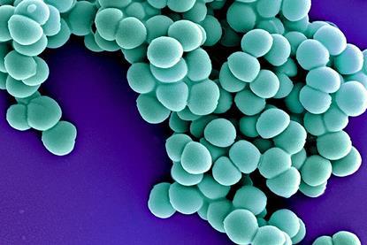 Methicillin-Resistant_Staphylococcus_Aureus_(MRSA)_Bacteria_colorized_scanning_electron_micrograph_-_22