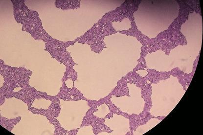 Rhodotorula_mucilaginosa_400x_img430