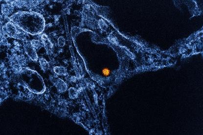 West_Nile_Virus_-_53865578133 (1)