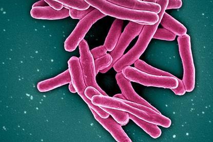 Mycobacterium_Tuberculosis_Bacteria,_the_Cause_of_TB_(52766234986)