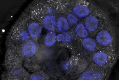 Low-Res_Microscope image of a lab-grown mini-lung showing flu virus particles (in blue) spreading across tissue