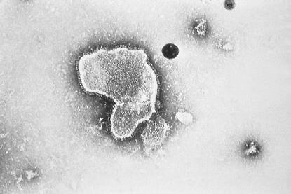 Respiratory_Syncytial_Virus_(RSV)_EM_PHIL_2175_lores