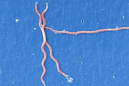 Lyme_disease_parasite_Borrelia_burgdorferi