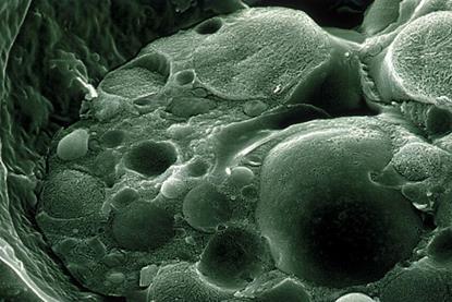 CSIRO_ScienceImage_1168_Scanning_Electron_Micrograph_of_Chytrid_Fungus