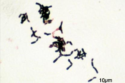 Bifidobacterium_adolescentis_Gram (1)