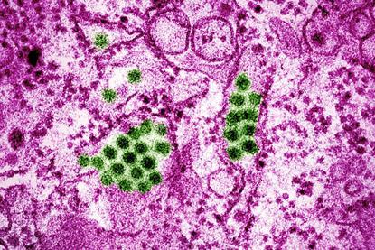 Dengue_Virus_Particles_(53231916461)