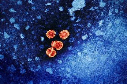 Hepatitis_B_Virus_(52444068124)