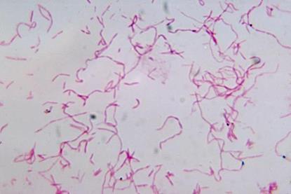 14123_2967_lores_595544_crop