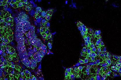 Salivary_Gland_Cells_infected_with_SARS-CoV-2_(51105883890)