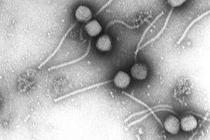 Gamma_phage