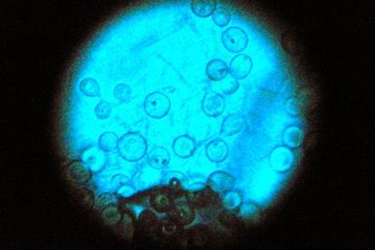 Aspergillus_nidulans_(15490521828)