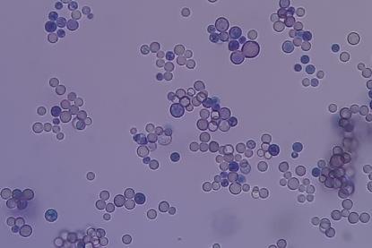 Cryptococcus_in_India_Ink
