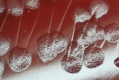 Pseudomonas_aeruginosa_colony_morphology_on_blood_agar