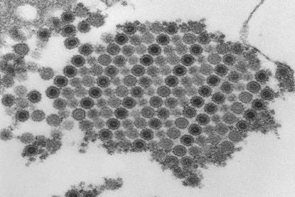 Chikungunya_virus_particles-PHIL-17369 (1)