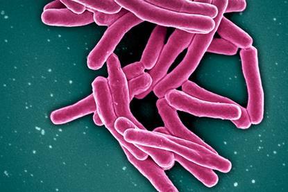 Mycobacterium_Tuberculosis_Bacteria,_the_Cause_of_TB_(52766234986)