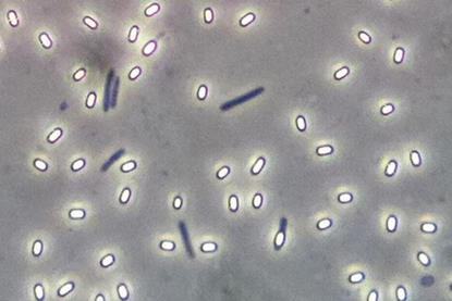 Low-Res_Endospore Bacillus (CCA-SA 3.0 Geoman3)
