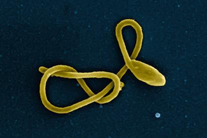 Ebola_Virus_Particle_(16436410472)