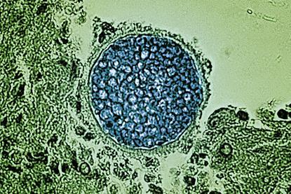 Coccidioides_Fungal_Spherule_-_12